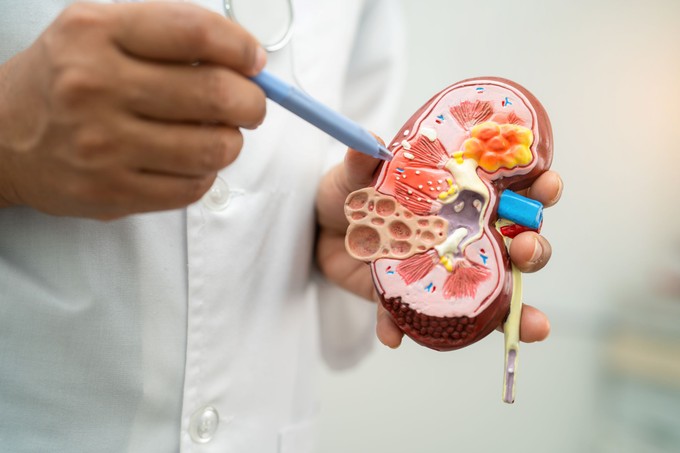 Mitől alakul ki a policisztás vesebetegség? című cikk nyitóképe