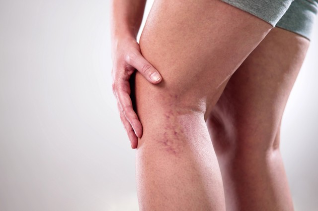 Vénás értorna - ezekben az esetekben érdemes végezni