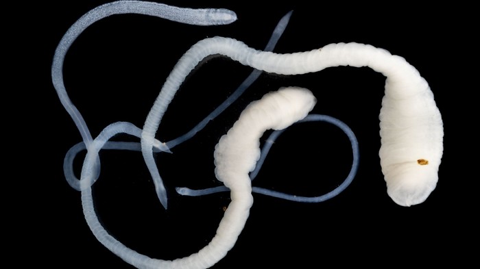 Ezek a tünetek jelezhetik azt, hogy galandféreg él a szervezetében