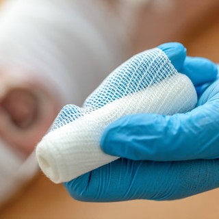 Hogyan gyógyítható a fekélyesedés? című cikk nyitóképe