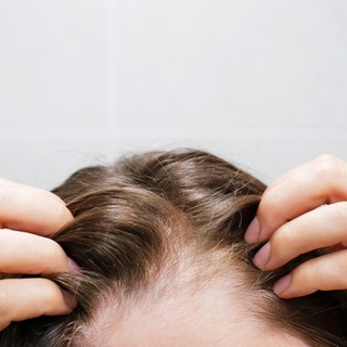 Mitől hullik a hajam? Gyakori okok, amikre kevesen gondolnak című cikk nyitóképe