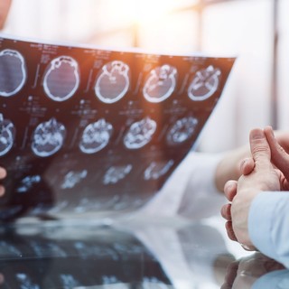 Nem csak fejfájás: 12 meglepő tünet, ami agydaganat jele is lehet című cikk nyitóképe