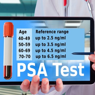 Mi a normális PSA-szint életkor szerint? Ezt jelzik a csillagos eltérések a leleten című cikk nyitóképe
