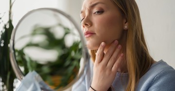  Száraz bőr: nem csak esztéikai probléma, betegséget is jelezhet 