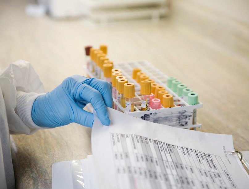 stratégiai megállapodás astrazeneca szte