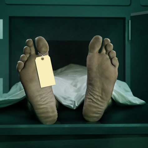 Meglepő felfedezés boncoláskor: ezért lehetnek színesek a nyirokcsomók halál után című cikk nyitóképe