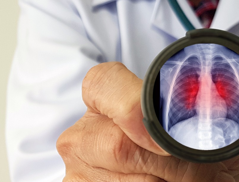 vakcinainfó, az orvos válaszol, ellenanyagszint, antigén teszt, koronavírus