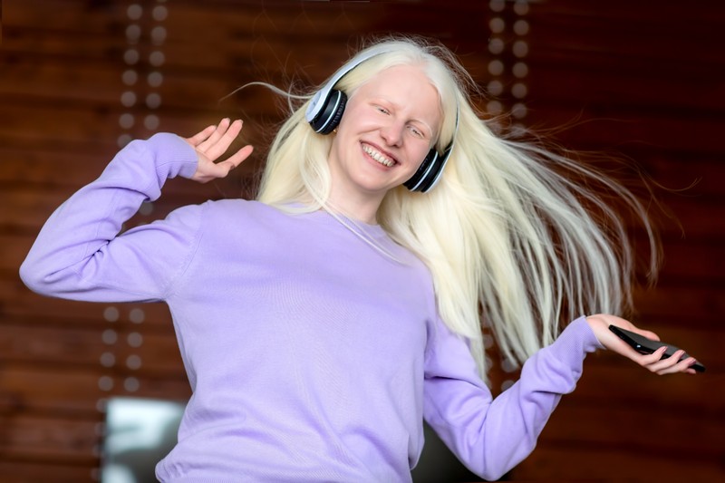 Albinizmus: tünetei, vizsgálata és kezelési lehetőségei