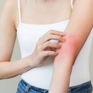 Gyermekek tízezreit érinti Magyarországon – így rontja az életminőséget az atópiás dermatitisz című cikk nyitóképe