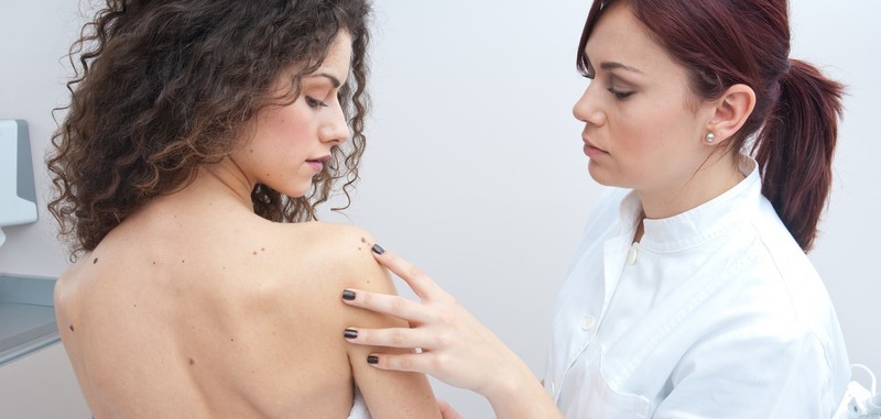 Gyanús anyajegyek? Figyelj oda rájuk!