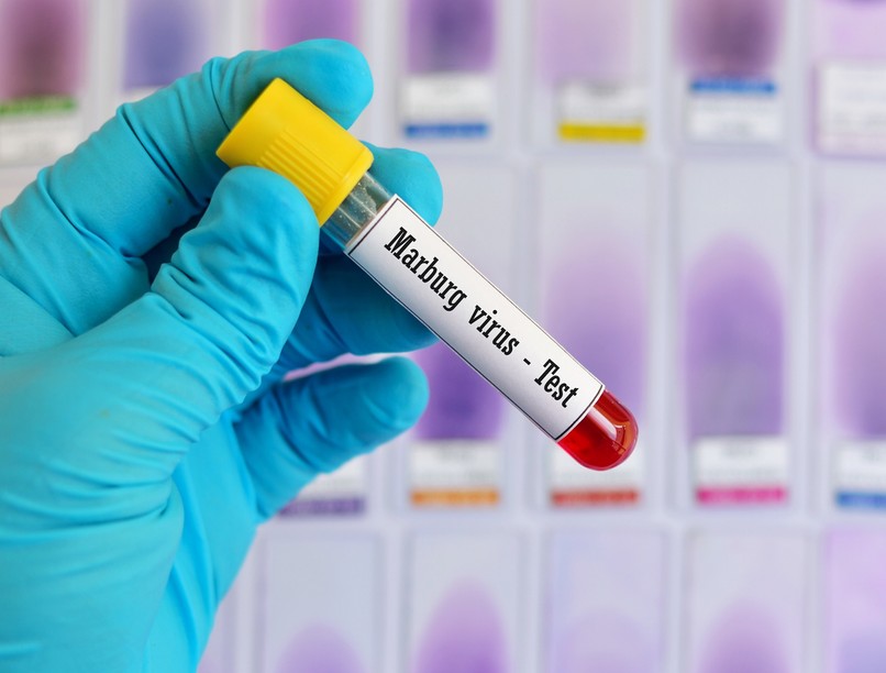 vérzéses láz Marburg Németország