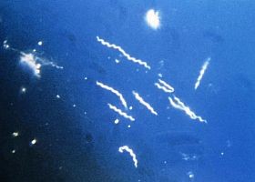 Kullancscsípés után 2. (Beküldjük-e a kullancsunkat vizsgálatra?)