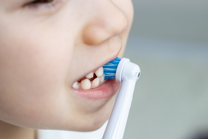 Nem mosnak elégszer fogat a magyar gyerekek című cikk nyitóképe