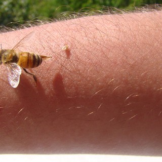 Rosszullét darázs-vagy méhcsípést követően: ezt tegye, hogy ne legyen baj! című cikk nyitóképe