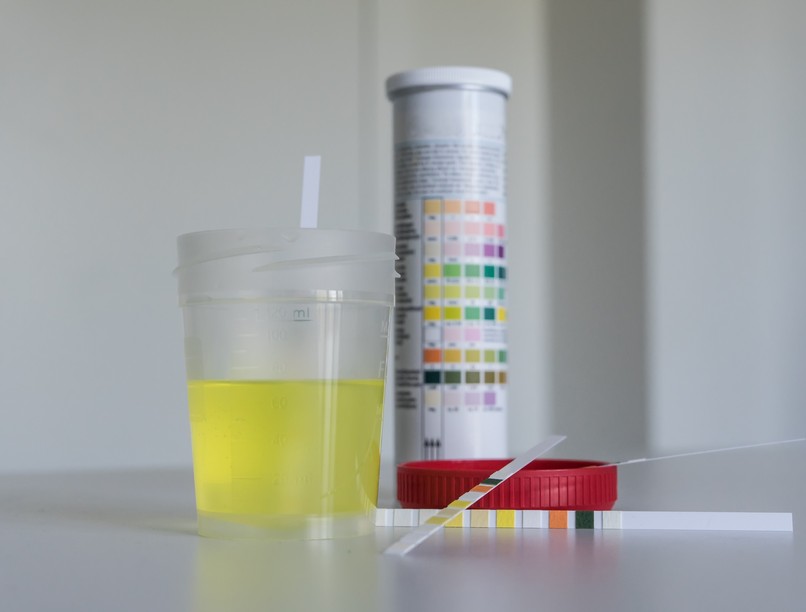 Mit jelent ketontestek érték laborlelet