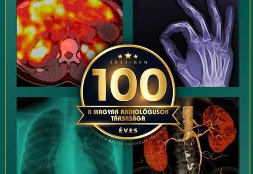 Így változtatta meg az orvoslást az "X-sugárzás" - 100 éves a Magyar Radiológusok Társasága