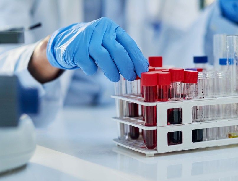 vérvizsgálat kimutat rák kutatás