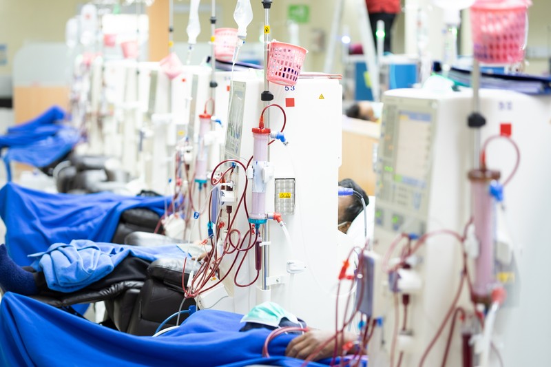 Mit jelent a dialízis?