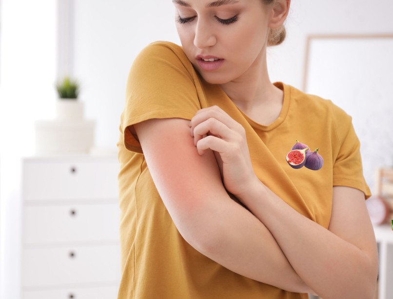 bőrkiütés füge allergia