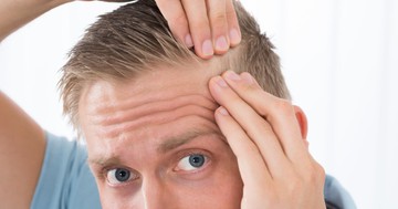  Kopaszodás, tesztoszteron, termékenység - így függ össze a férfiaknál 