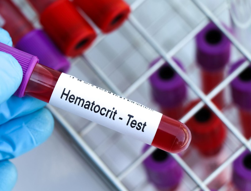 hematokrit, htc, alacsony, magas mit jelent