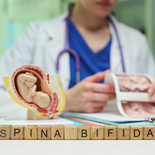 Nyitott gerinc tünetei, vizsgálata és kezelése című cikk nyitóképe