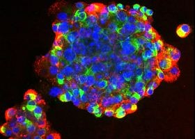 Mágnesezett őssejtekkel a szívizom gyógyulásáért!