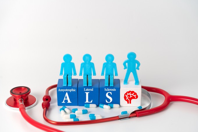 Mitől alakul ki az ALS, és miért olyan nehéz megérteni ezt a betegséget? című cikk nyitóképe