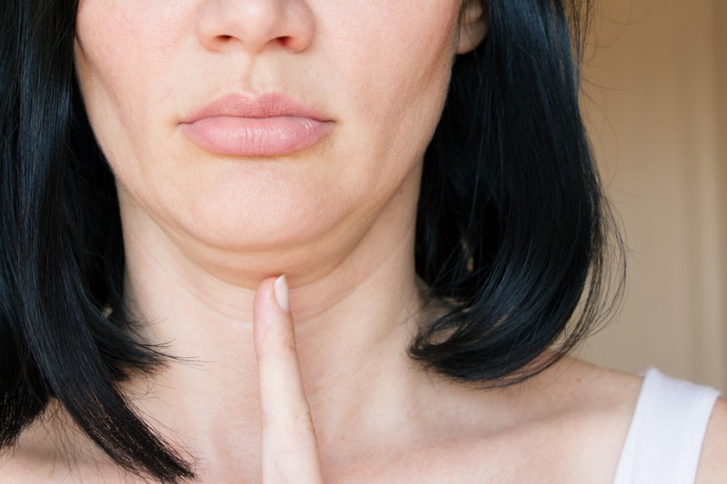 Hogyan lehet eltünteni a tokát otthon? Ezeket az arcjóga gyakorlatokat próbálja ki!