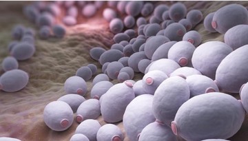 Candida-gomba: ezt írja fel ellene az orvos, ha nagyon elszaporodik