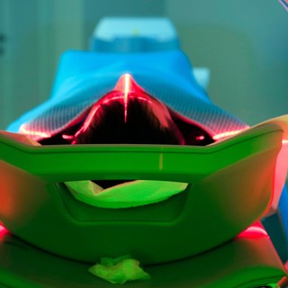 Mi a sugárkezelés (radioterápia)? című cikk nyitóképe