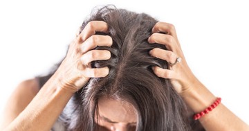  Nem korpásodik a fejbőre, mégis viszket? Ez az oka 