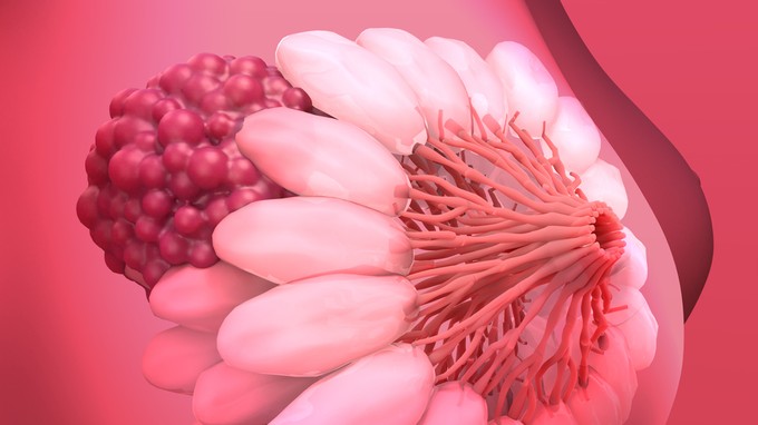 Ilyen gyógyszert fejlesztenek a legrosszabb prognózisú daganatok ellen című cikk nyitóképe