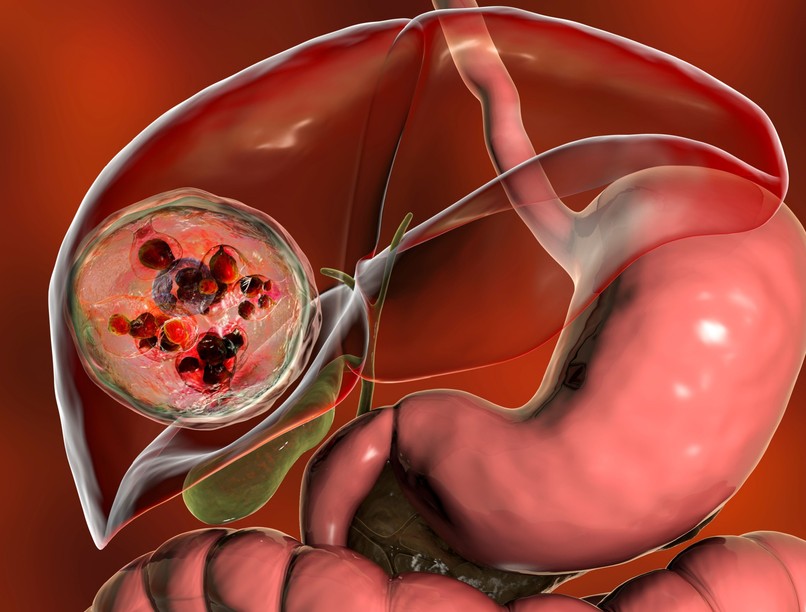 fertőzés máj parazita élősködő jele tünete