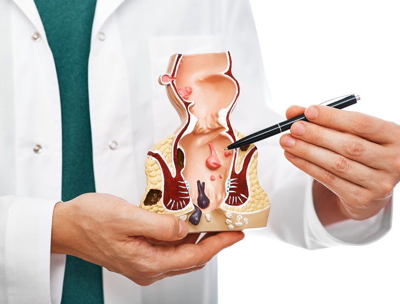 Végbélnyílás, végbéltájék, viszketés, oka, tünetei, kezelése, fertőzés