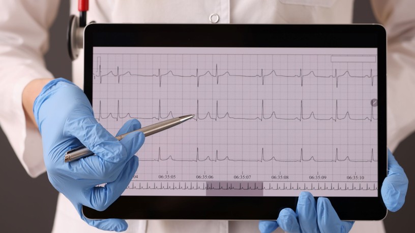 Mi az EKG Elektrokardiogram leírás