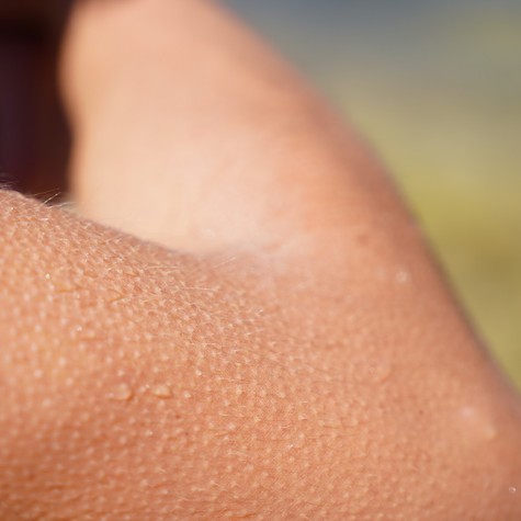 Miért leszünk libabőrösek egy megható pillanattól? Ez történik a testünkben című cikk nyitóképe