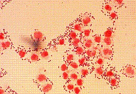 Szájban élő baktérium - és a tüdőgyulladás?