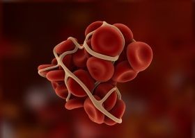 Vashiánytól - a mélyvénás trombózisig