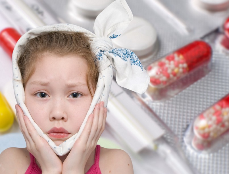 mumpsz, fertőző gyerekbetegségek, vírusfertőzés, gyerekbetegségek