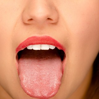 Mire utal a nyelvduzzanat? című cikk nyitóképe