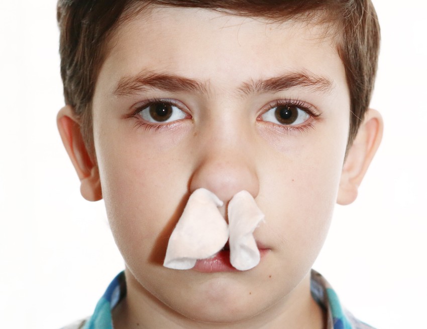 Ne tamponálja az orrlyukat, mert a tampon megduzzad, és feszítő hatással van az orrszárnyakra.