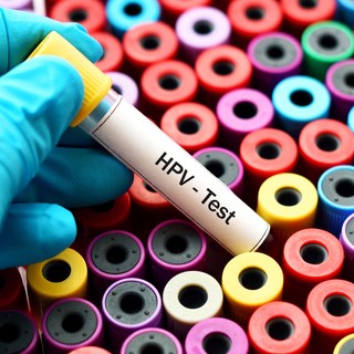 HPV-fertőzés: ezzel az új magyar módszerrel gyógyítanak betegeket című cikk nyitóképe