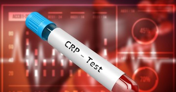  Mennyi a magas CRP-szint, mikortól jelez betegséget és mit árul el a CRP a szívroham kockázatáról? 