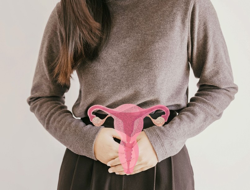 honnan tudom hogy pcos vagyok