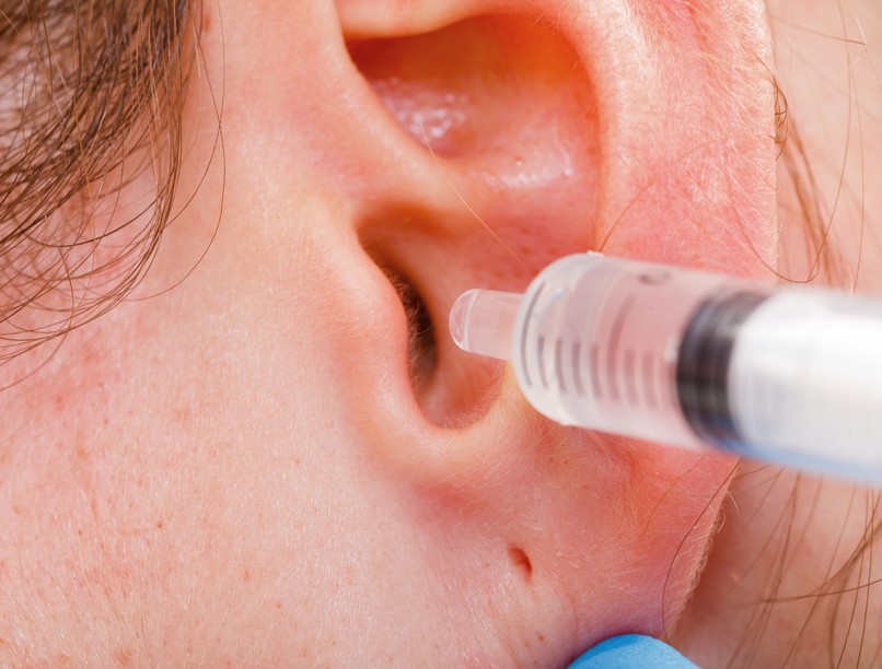 fülzsír, fültisztítás, helyesen fülzsírdugó