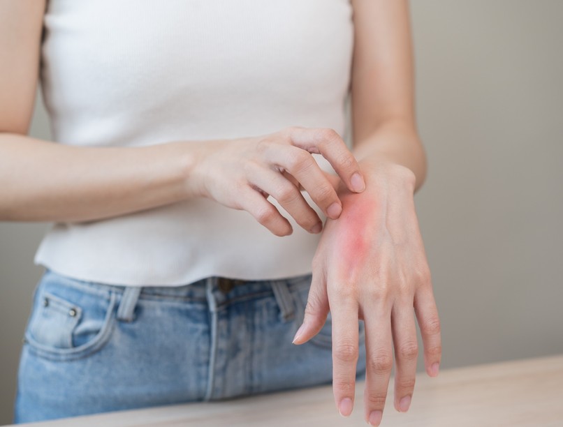 Allergia kontrasztanyag MR orvos válaszol