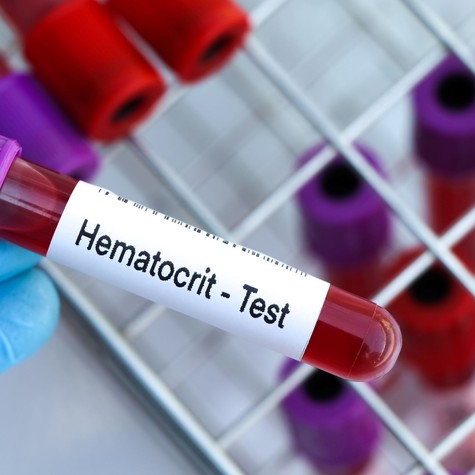 Hematokrit a vérképben: ezt jelenti, ha túl magas vagy túl alacsony az érték című cikk nyitóképe