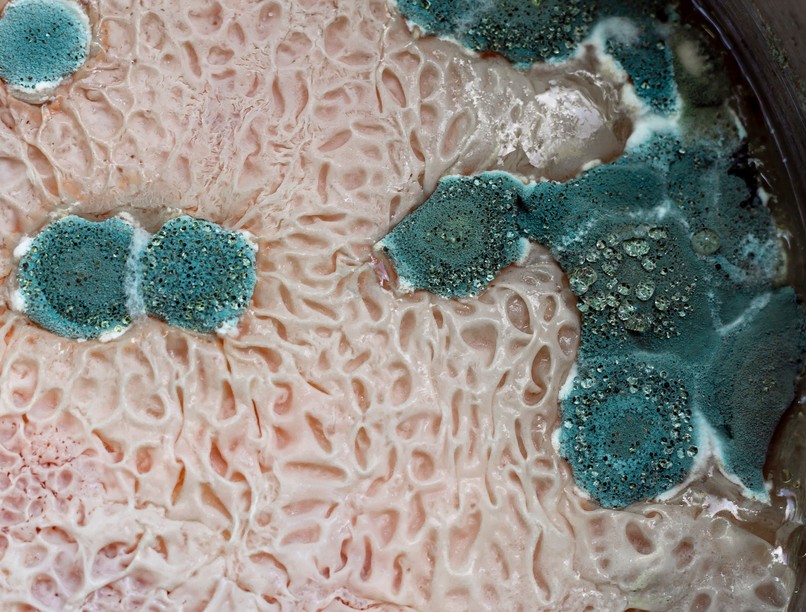 szerveket érintő gombás fertőzések