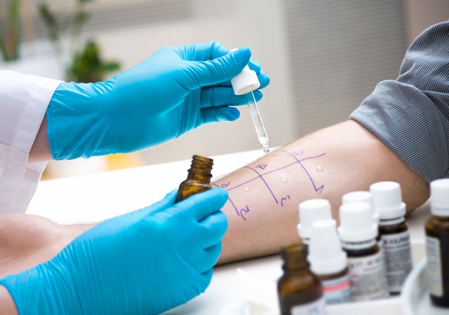 Ételallergiára gyanakszik? 4 vizsgálat is kimutathatja, de előtte ez a legfontosabb!